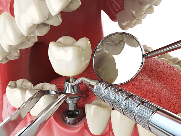Best Orthodontic Emergency Dentist in Lake Orion, MI
