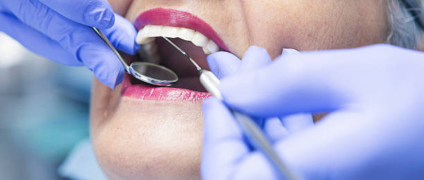 Best Emergency Dental Extractions in Lake Orion, MI