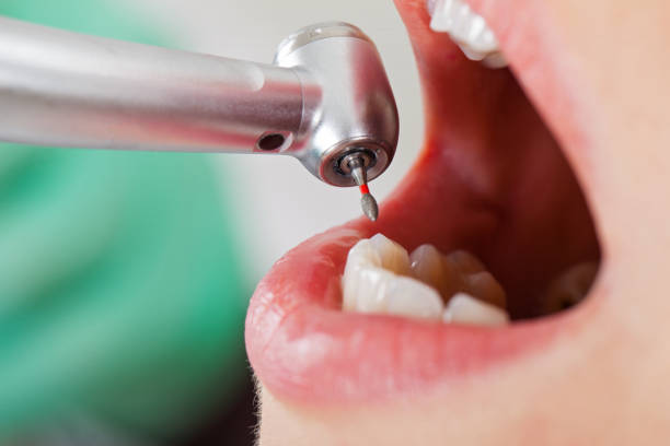 Best Emergency Dental Services for Seniors in Lake Orion, MI